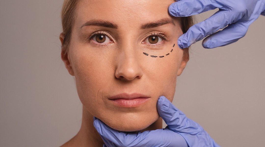 Harmonização-facial